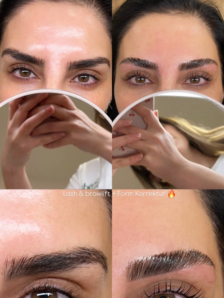 Browlift Ergebnis – definierte Augenbrauen im Detail