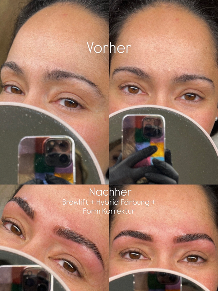 Browlift Vorher-Nachher – symmetrische Augenbrauen