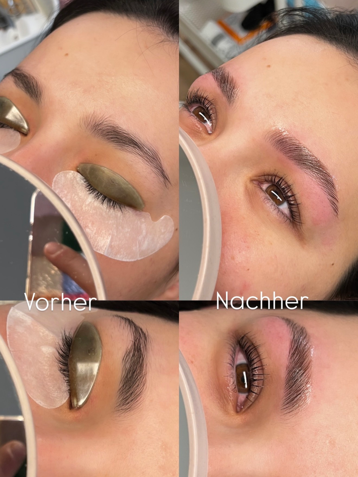 Vorher-Nachher Browlift – vollständige Transformation